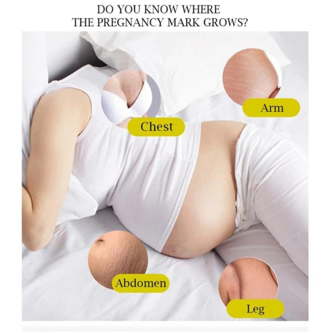 Trujuli Stretch Mark Lotion-1 fl oz